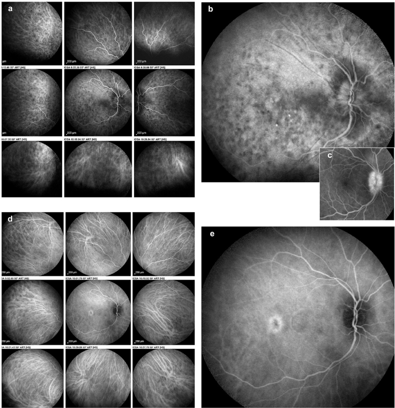 Fig. 1