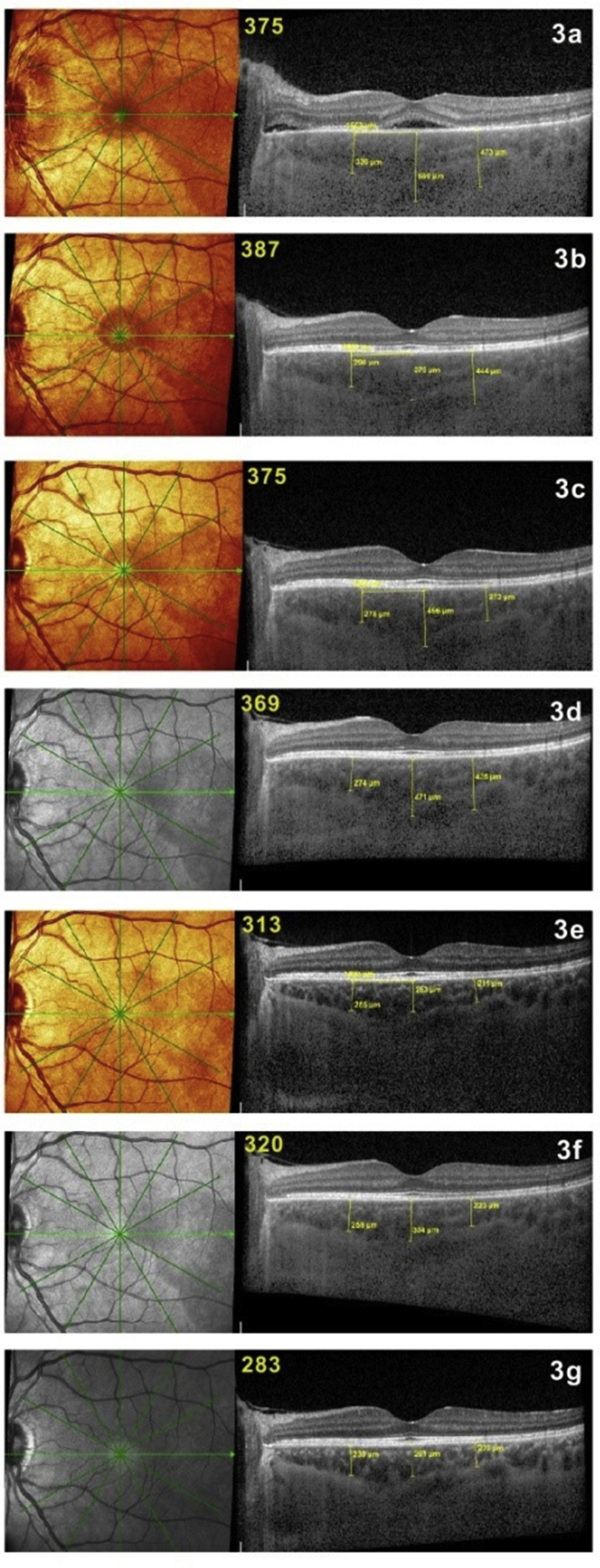 Fig. 3