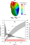 Thermal results for the benchmark case of the rat heart model—Case I (Table 3): (a) temperature distribution at the end of nanowarming superimposed on the heart model, when the lowest temperature in the heart surpasses −35 °C and (b) thermal history in the heart muscle during the process of nanowarming