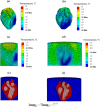 Temperature distribution comparison for rat heart model between a small cylindrical container and a large cylindrical container in Case II (Tables 1 and 3, Fig. 6): (a) and (b) temperature distribution in the heart cross sections where the lowest temperature is found; (c) and (d) the corresponding temperature distribution across the heart and the surrounding CPA solution; and (e) and (f) the FEA mesh in that cross section, highlighting the heart geometric model, where red represents the heart muscle, blue represents the surrounding CPA solution, and pink represents the CPA solution within the heart chambers. Note that the same rat heart model is used in both cases, but the smaller cylinder is selected to tightly fit the heart, while the geometric center of the heart is aligned with the cylinder centerline for the larger container. This difference in positioning results in different heart cross section contours displayed between Figs. 7(e) and 7(f).