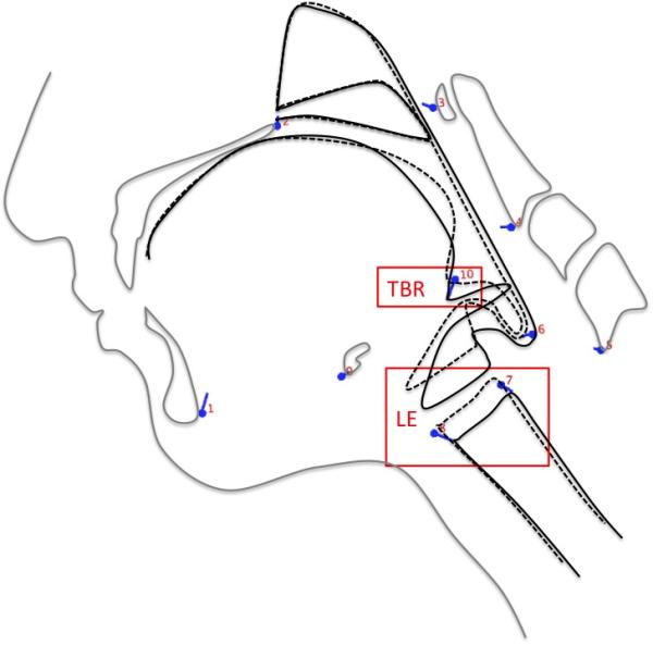 Figure 3b