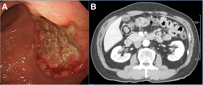 Fig. 1