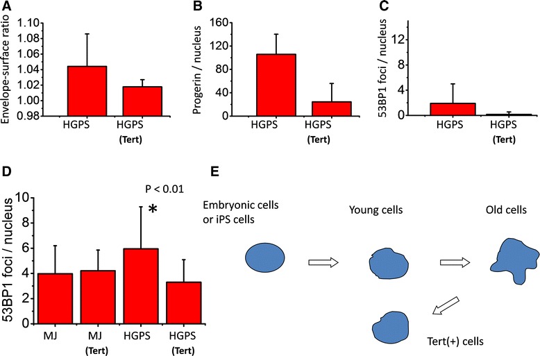 Progerin, the protein responsible for the Hutchinson-Gilford progeria ...