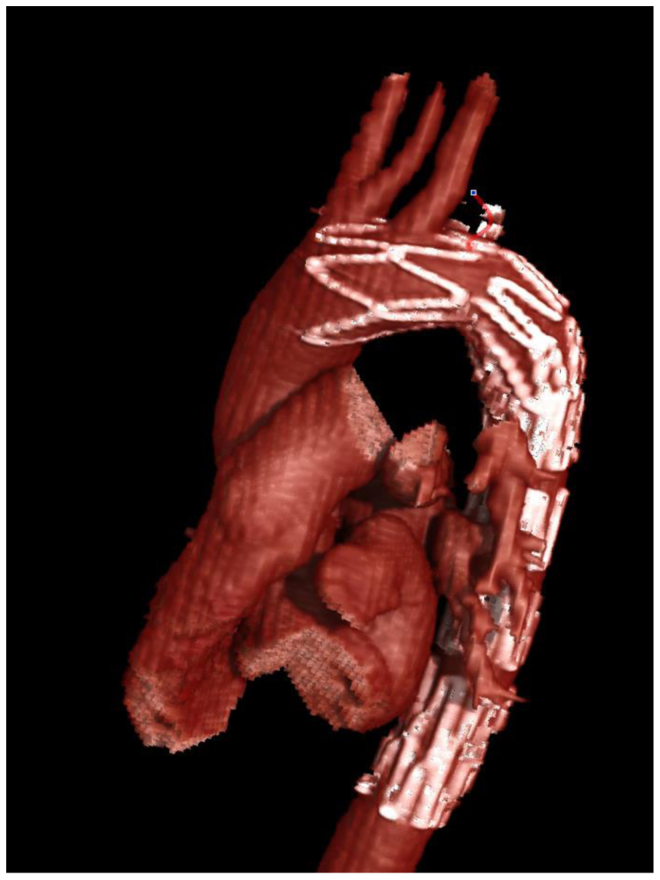 Fig 3
