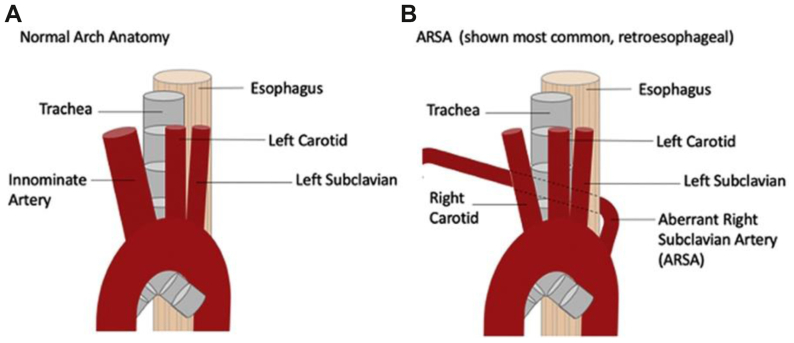 Fig 1