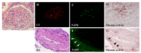 Figure 22