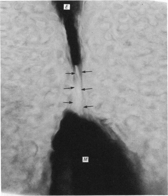 Fig. 14