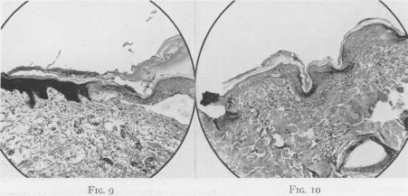 Fig. 9., Fig. 10.