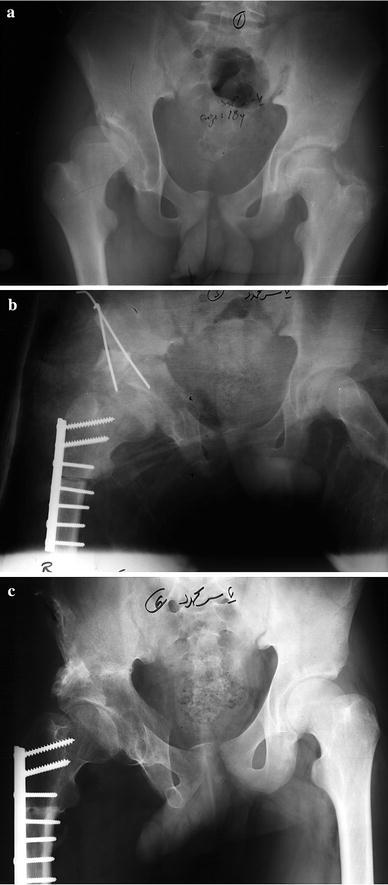 Fig. 6a–c