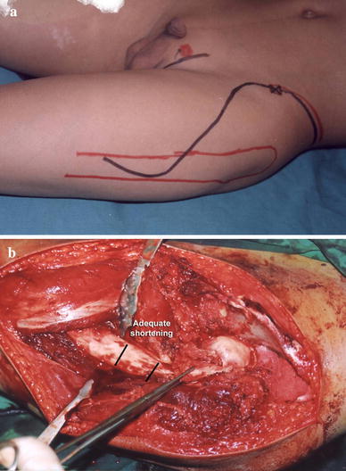 Fig. 1a, b