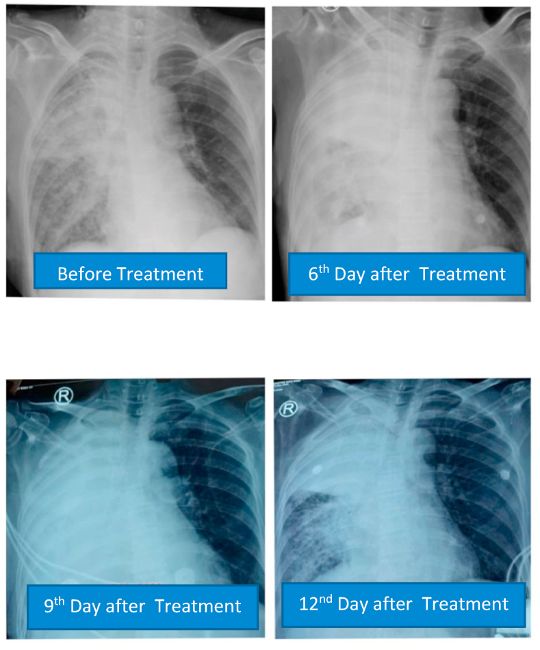 Fig. 4