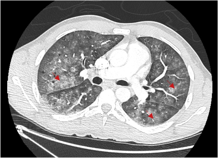 Fig. 1