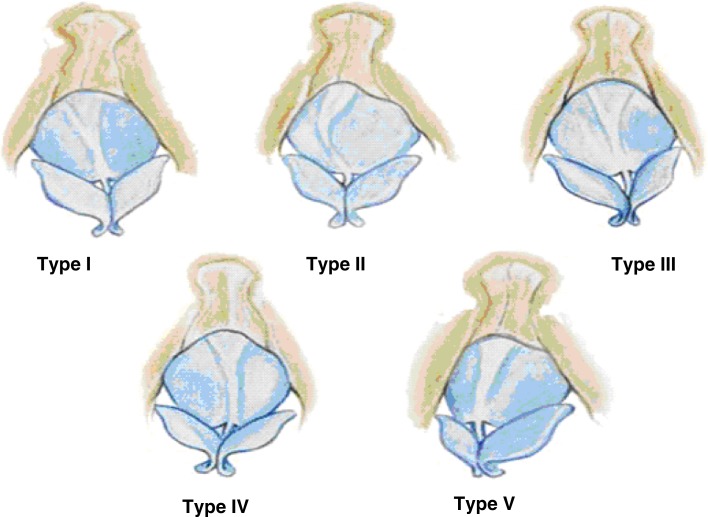 Fig. 2