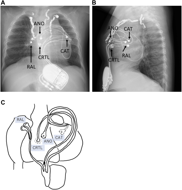 Figure 2