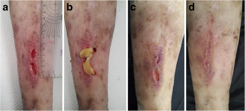 Fig. 4
