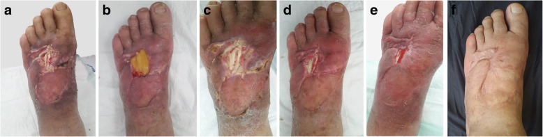 Fig. 2