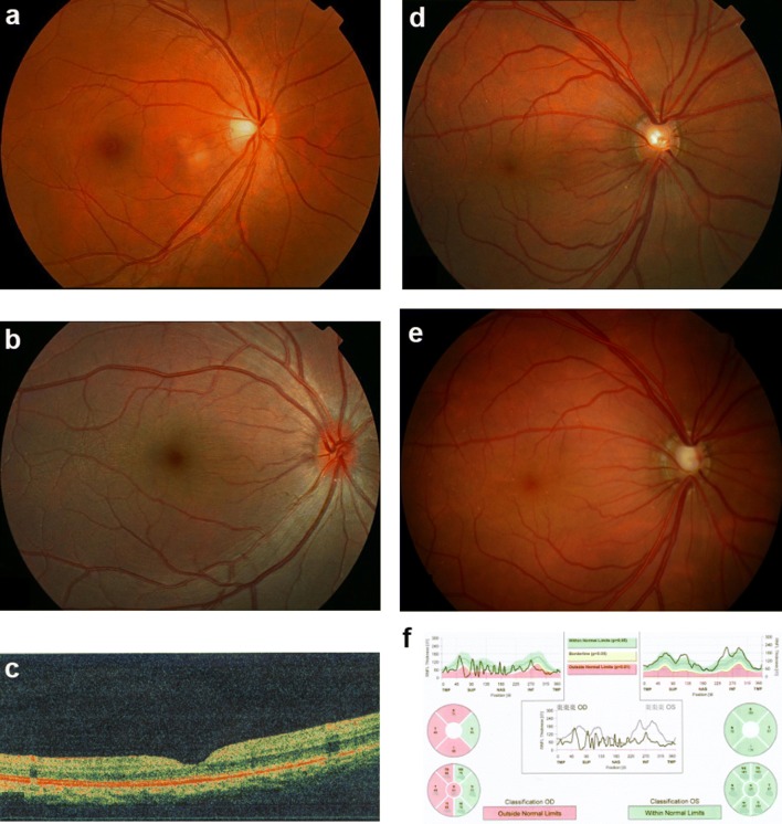 Fig. 2