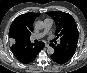 Fig. 21