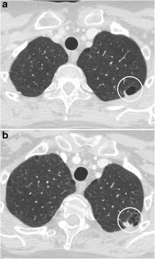 Fig. 27