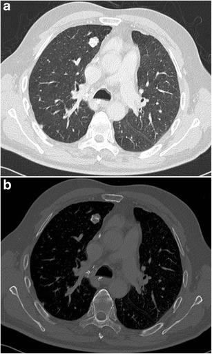 Fig. 16