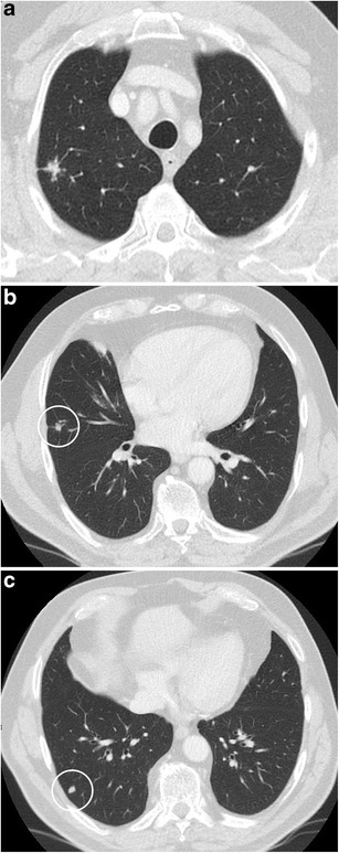 Fig. 12