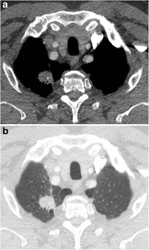 Fig. 17