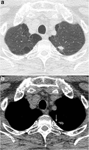 Fig. 22