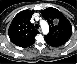 Fig. 14