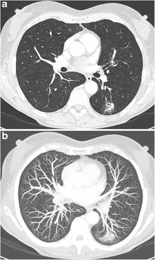 Fig. 28