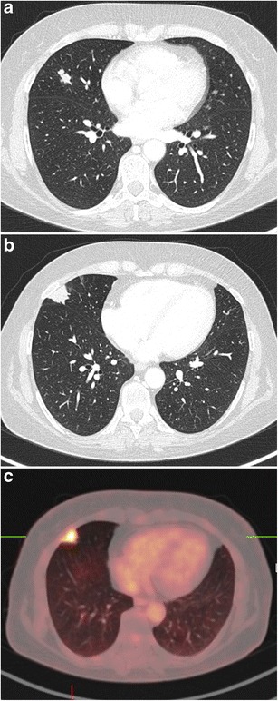 Fig. 13