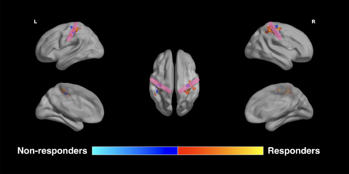 Fig. 2: