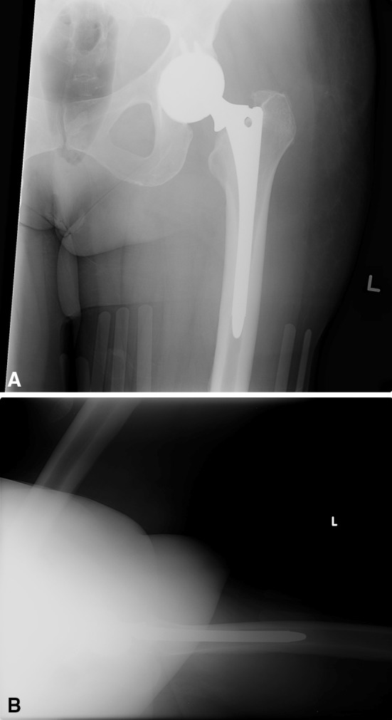 Fig. 1A–B