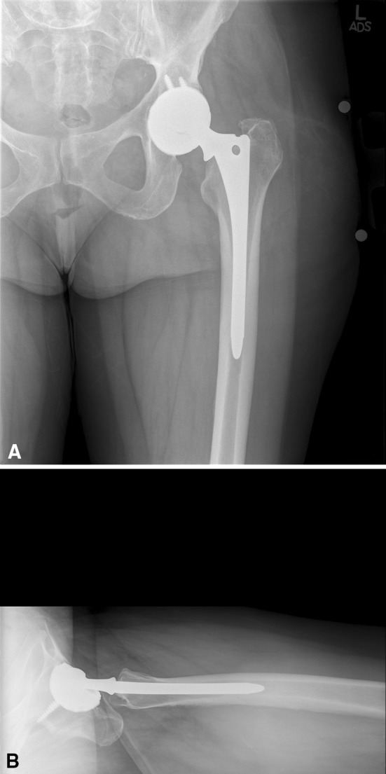 Fig. 2A–B