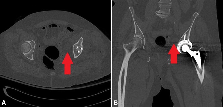 Fig. 4A–B