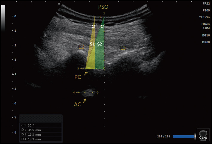 Fig. 3