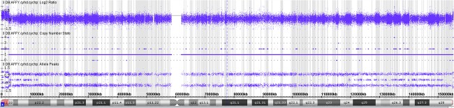 Digynic triploidy: utility and challenges of noninvasive prenatal ...