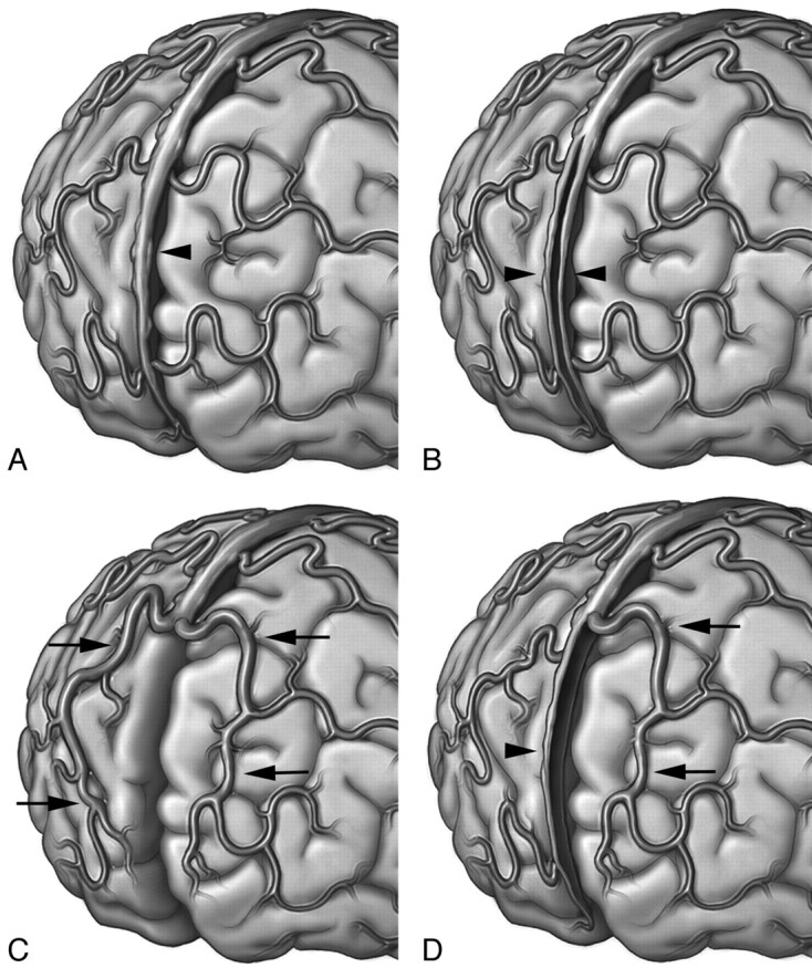 Fig 5.