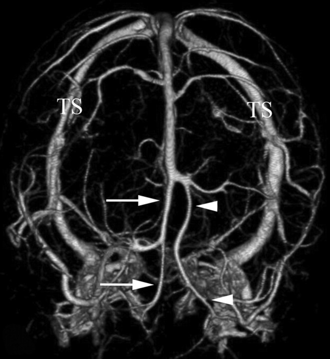 Fig 2.