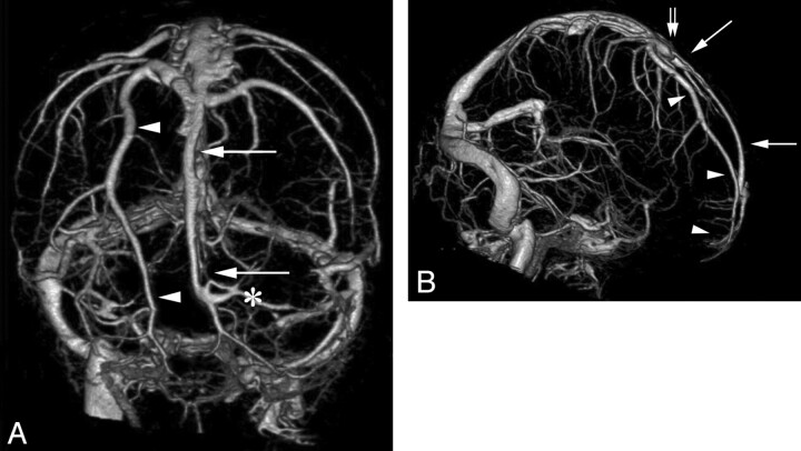 Fig 1.