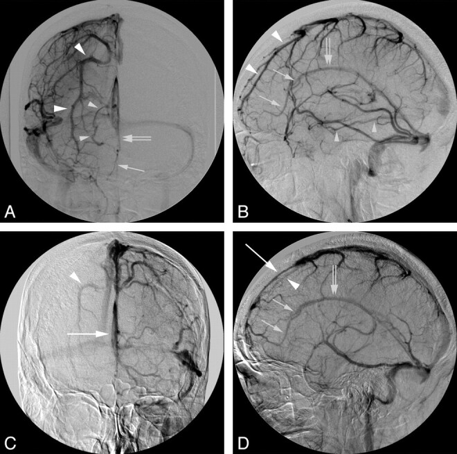 Fig 3.