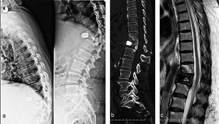 Fig. 3a