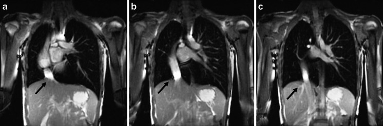 Fig. 15