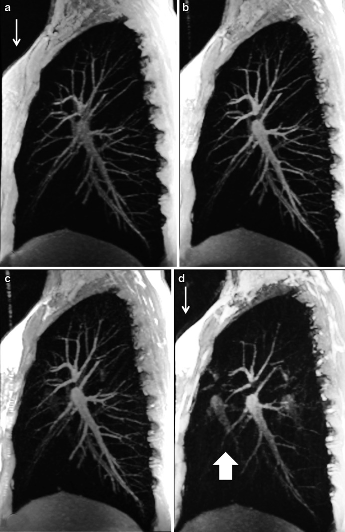 Fig. 14