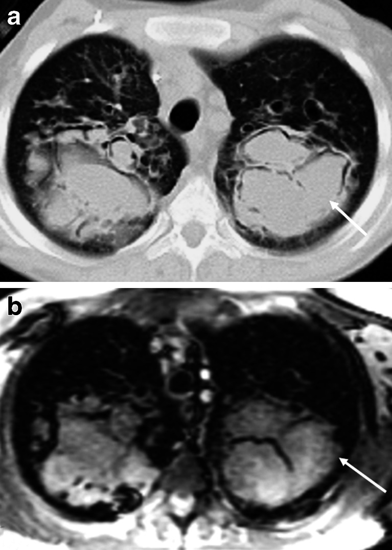 Fig. 10