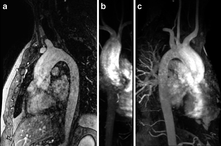 Fig. 17