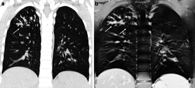 Fig. 13