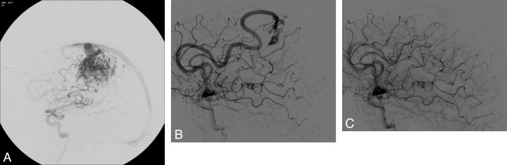 Fig 2.