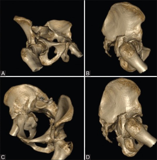 Figure 3 (A-D)