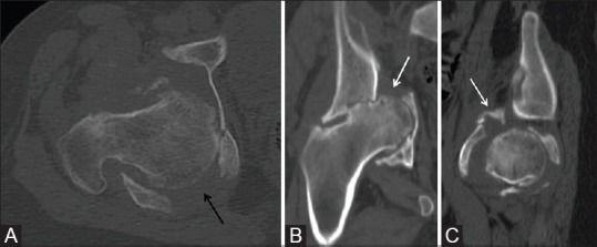 Figure 2 (A-C)