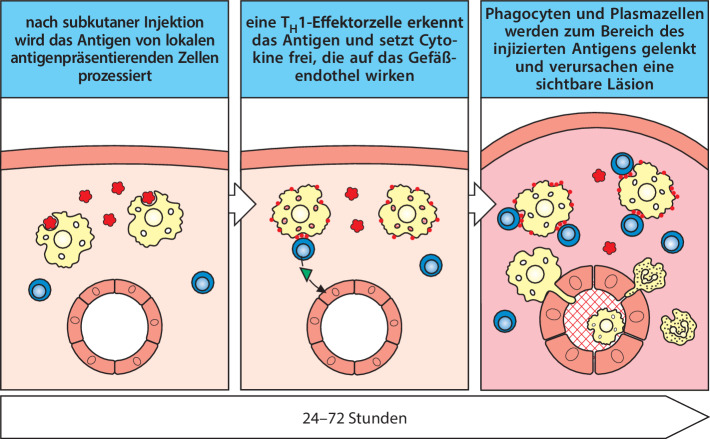 graphic file with name 978-3-662-56004-4_14_Fig20_HTML.jpg